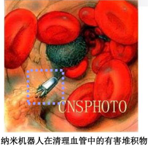 納米機器人在清理血管中的有害堆積物