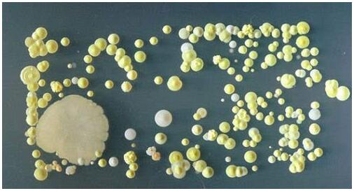 手機表面細菌 手機表面細菌